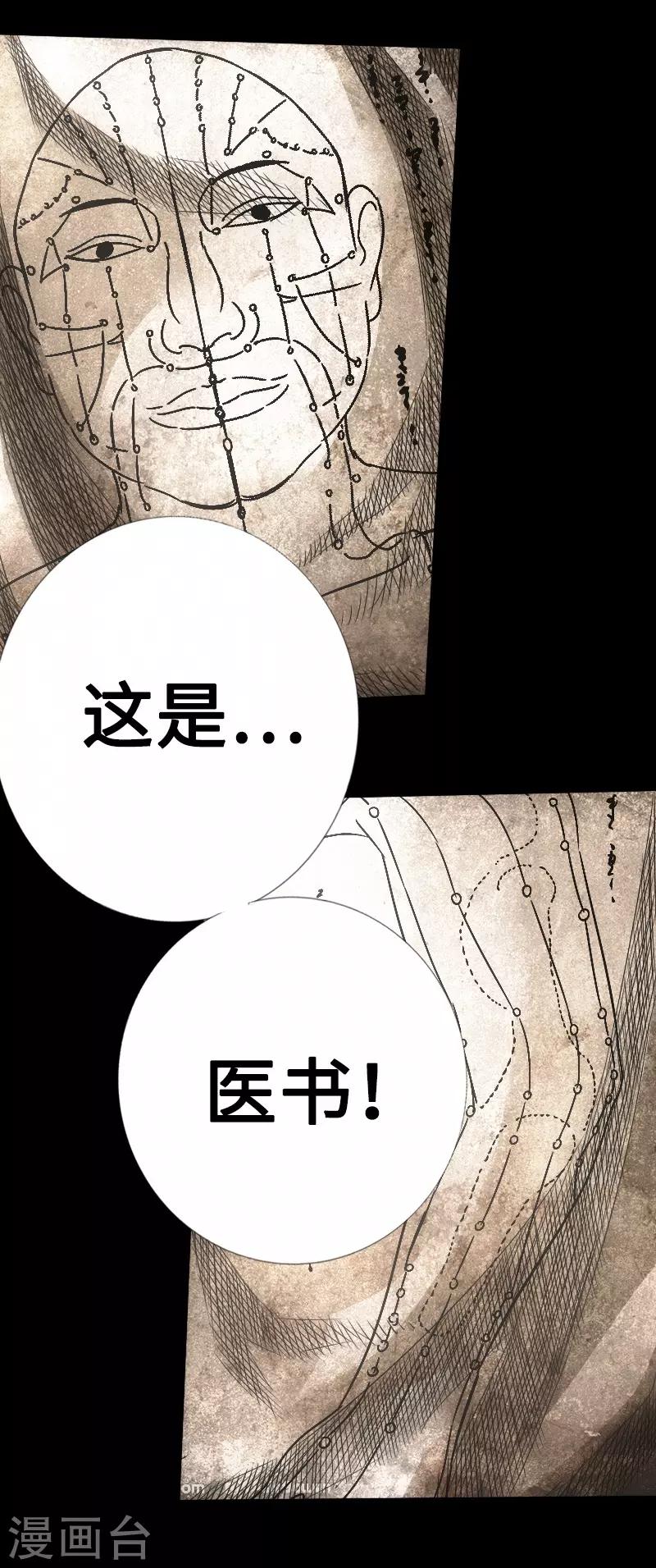 第20话 金针秘术-第21话