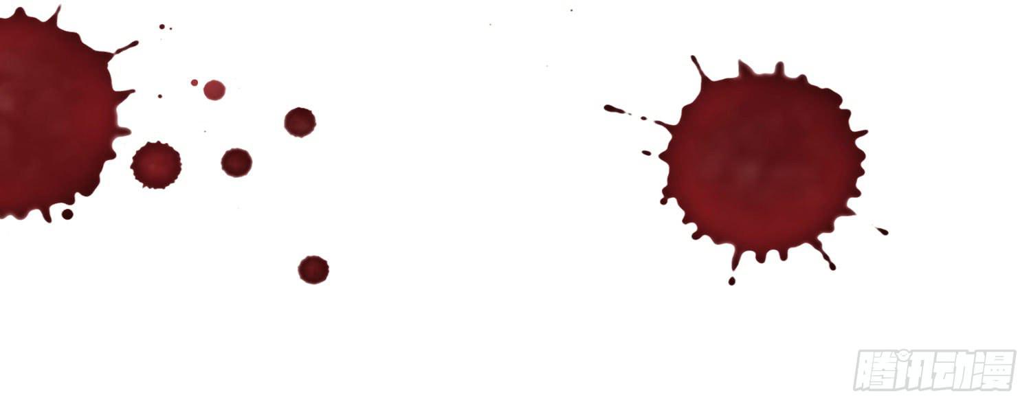 矛盾(1/3)-第29话