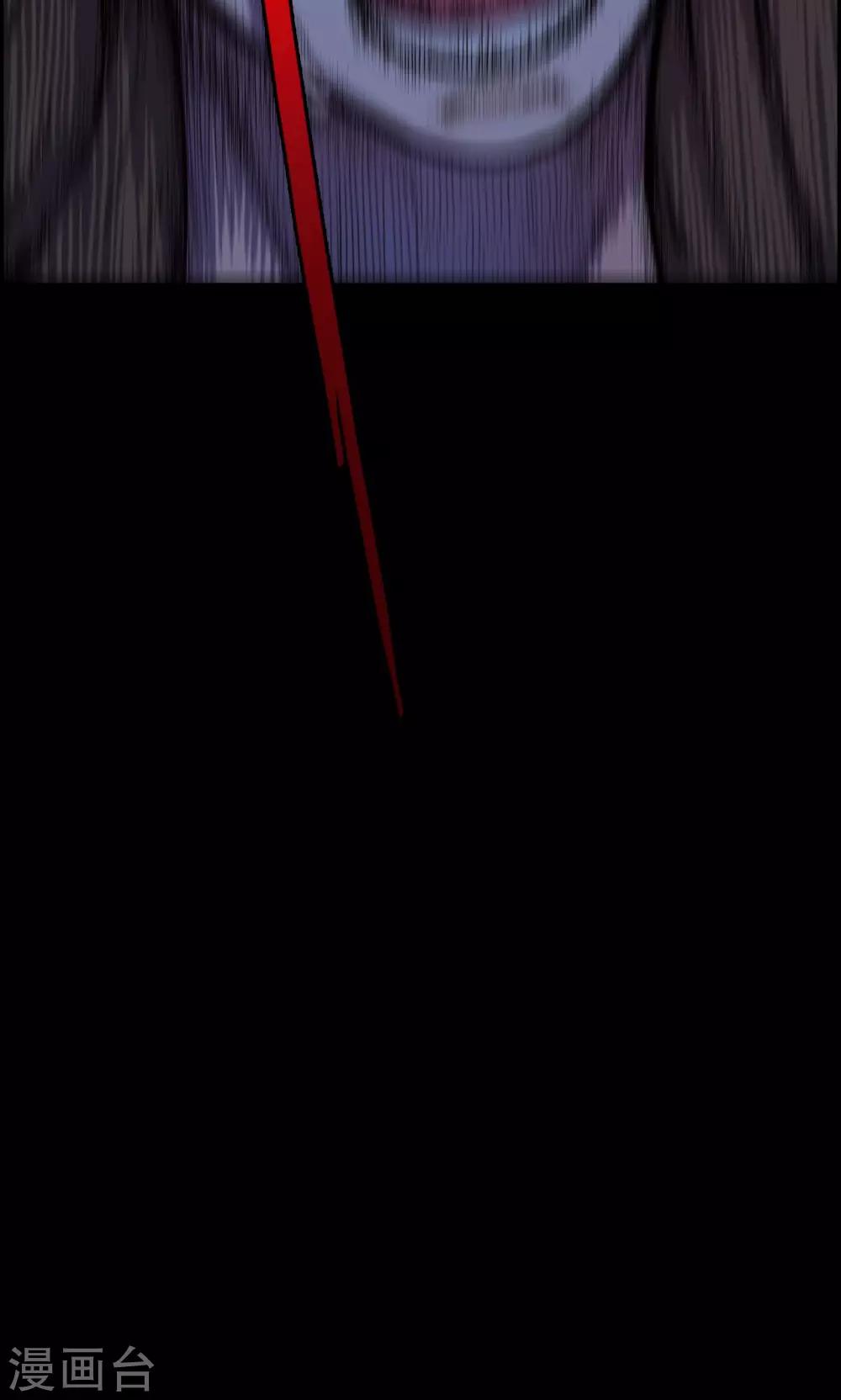 第19话 植发4-第19话