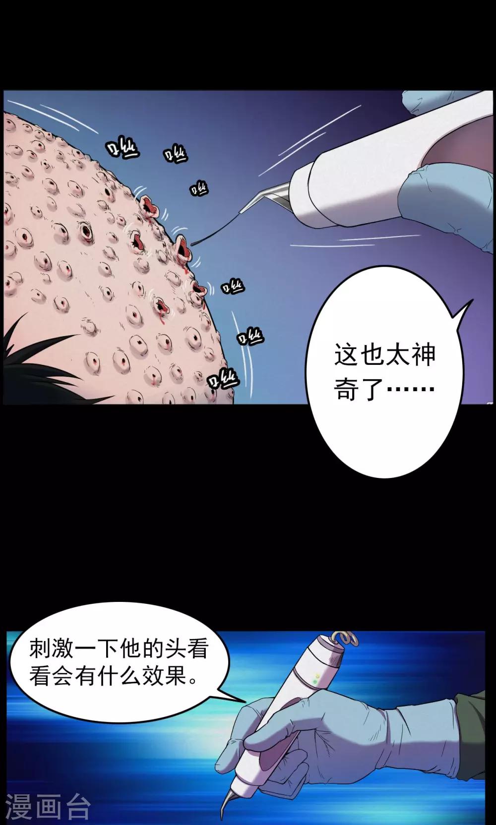 第19话 植发4-第19话