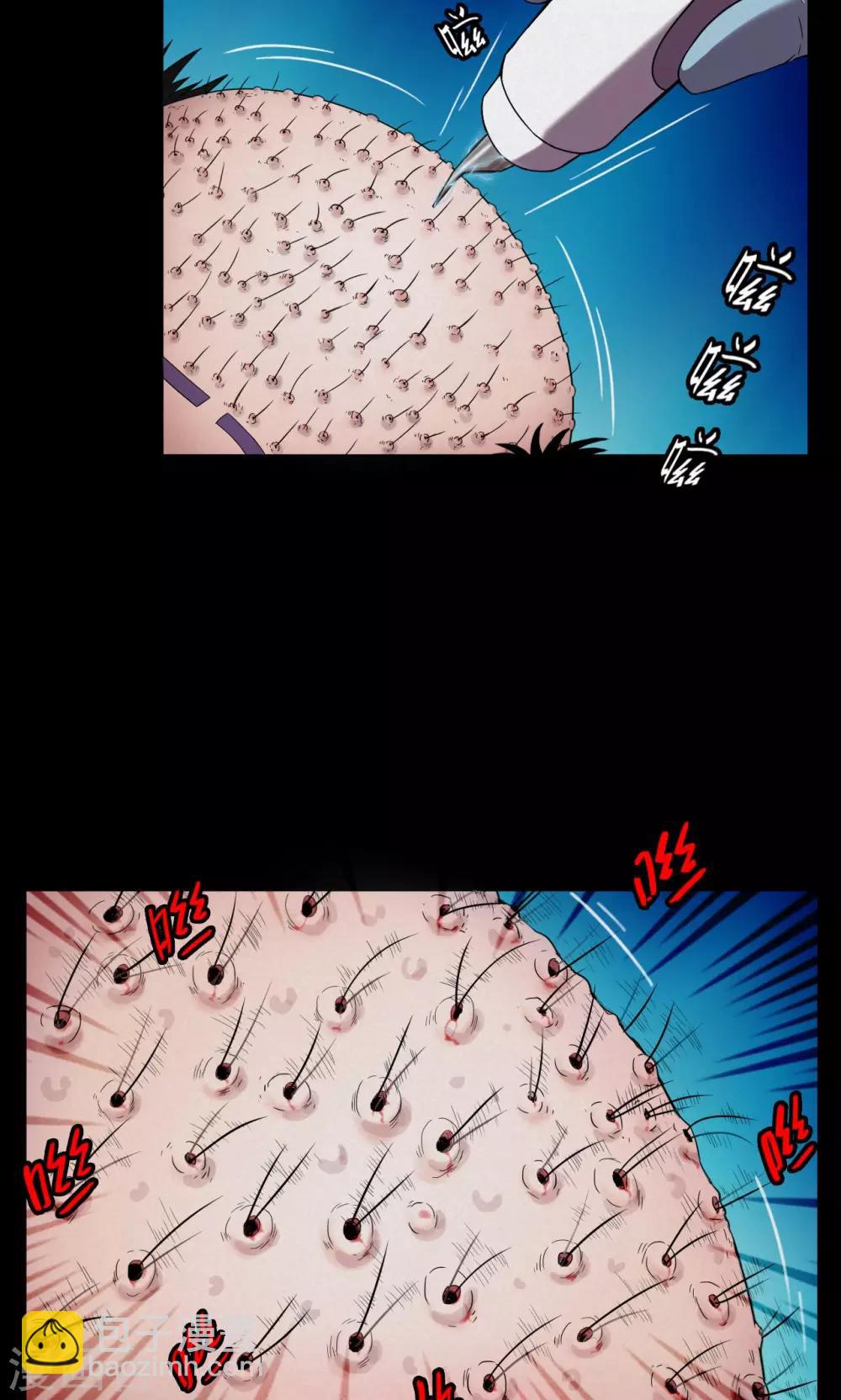 第19话 植发4-第19话