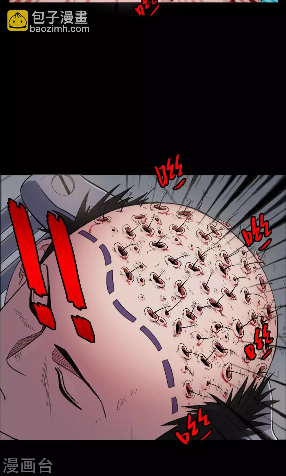 第19话 植发4-第19话