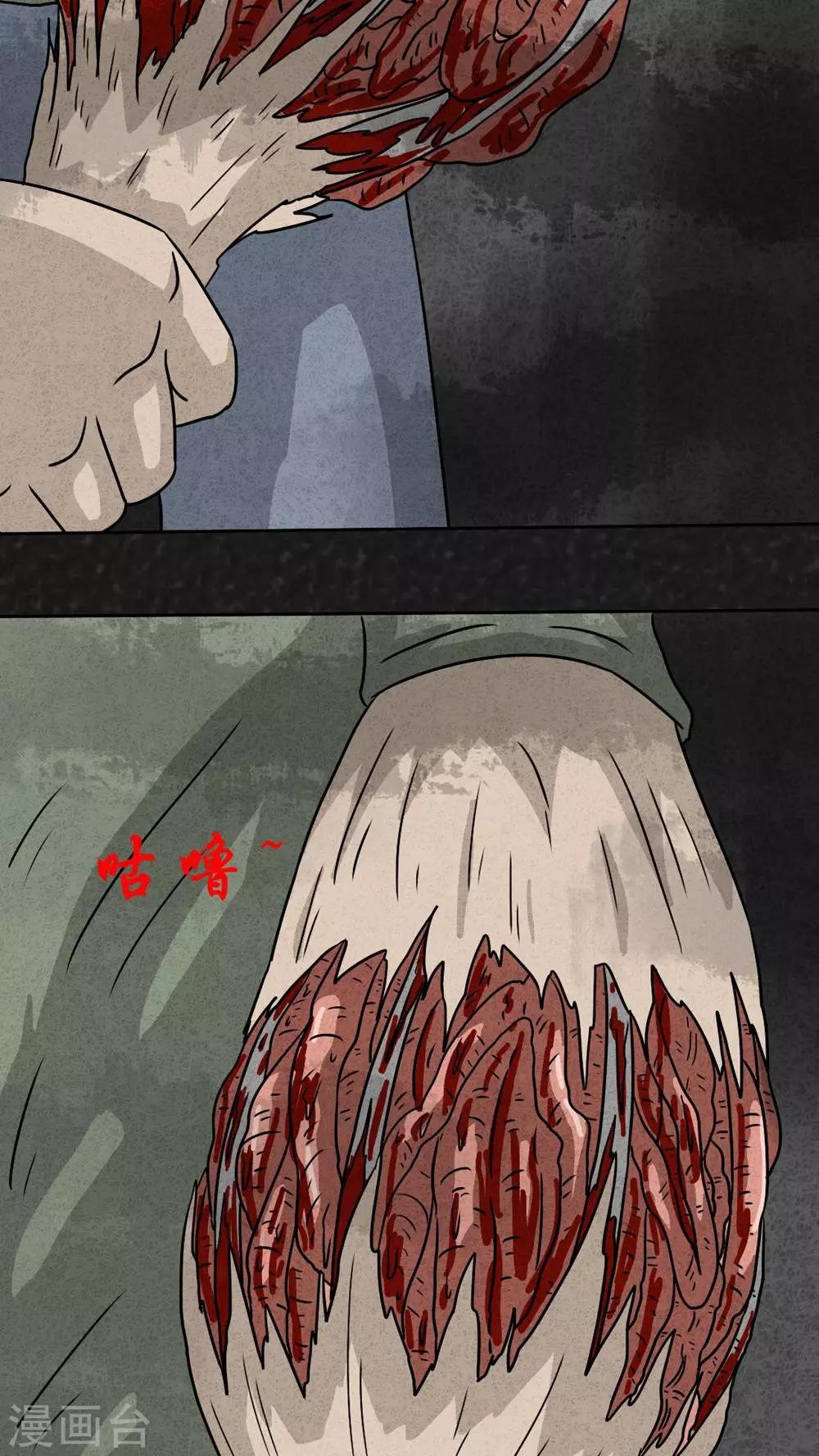 第21话 内脏大盗（下）-第21话