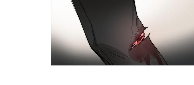 我会下手快点(1/2)-第17话