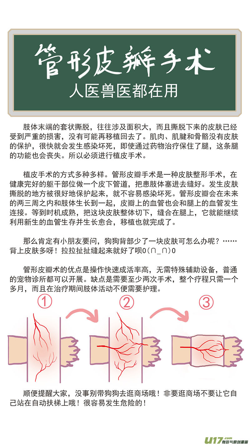 115 袖套状撕脱（管形皮瓣术）-第115话