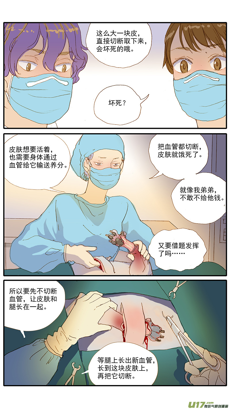 115 袖套状撕脱（管形皮瓣术）-第115话