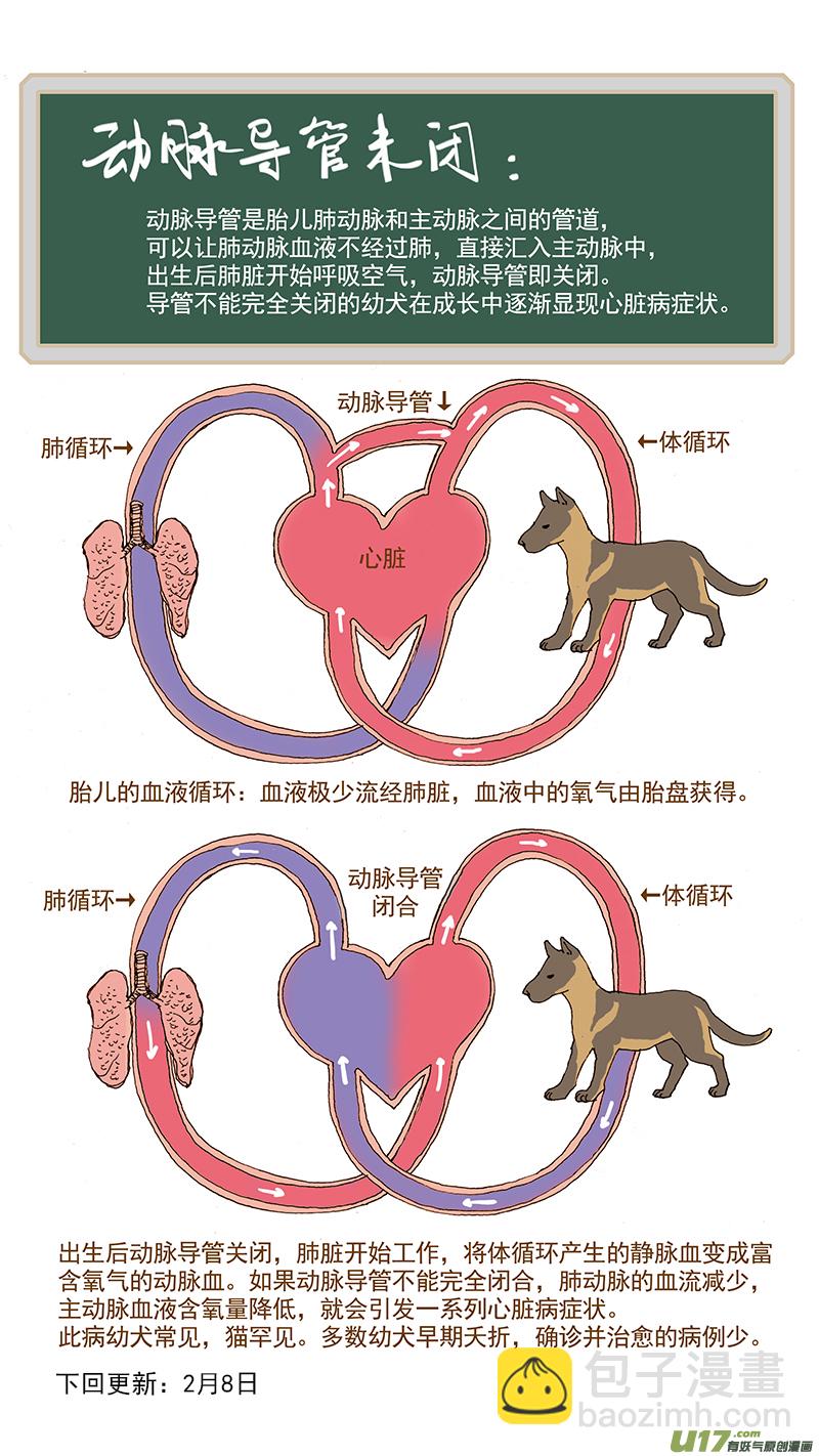 043 动脉导管未闭-第43话