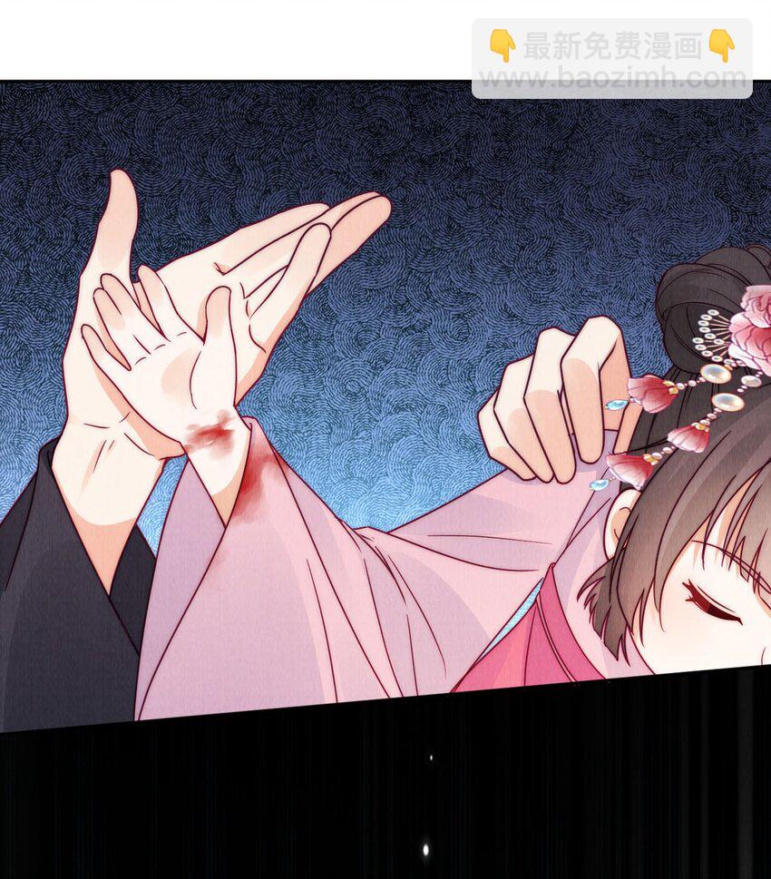 21 放血！(1/2)-第21话