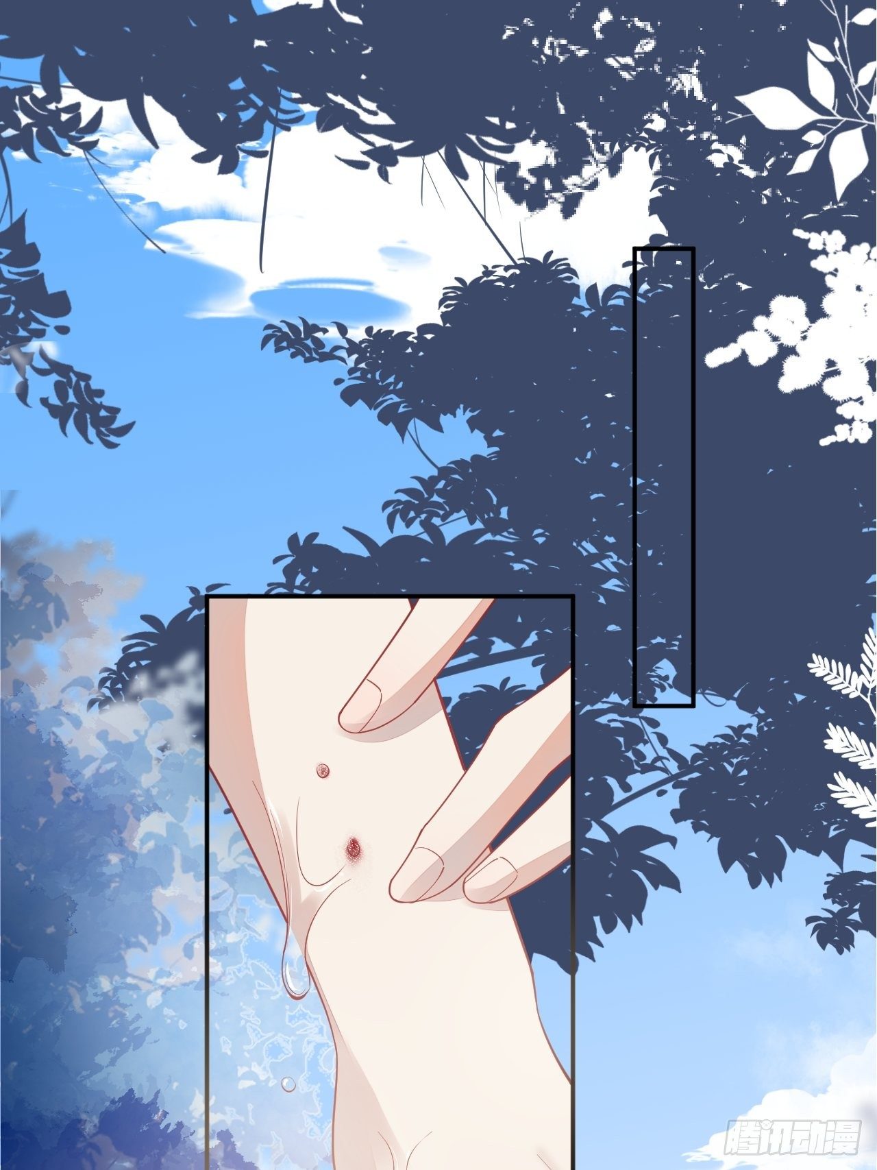 56-夏洛特被蛇咬了(1/2)-第57话