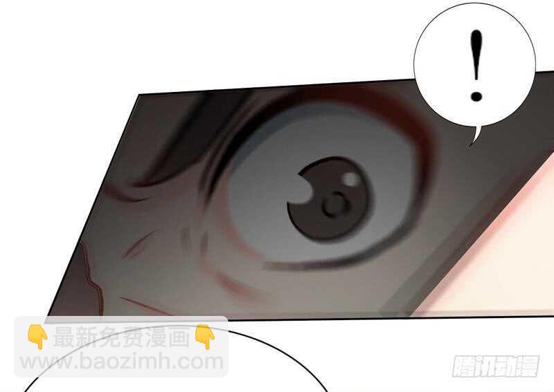 帝少專寵霸道妻 - 第119話 爲夫流血了 - 2