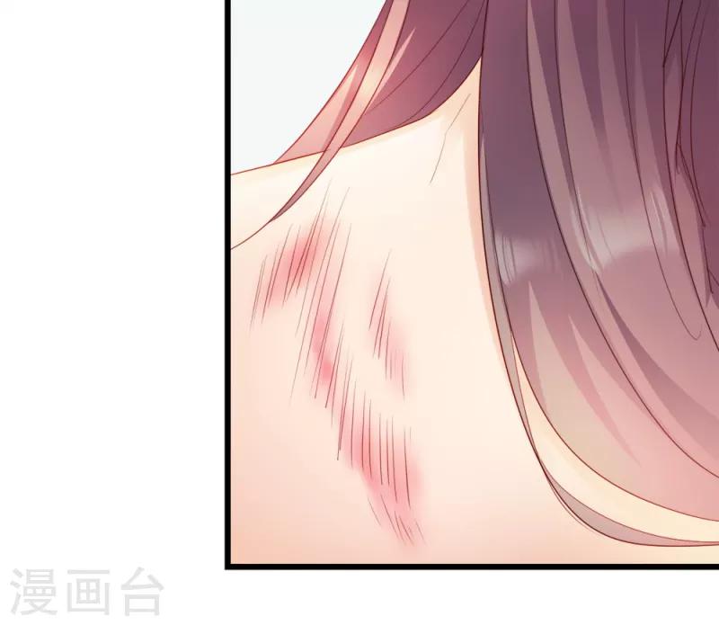 第57话 擦药-第57话