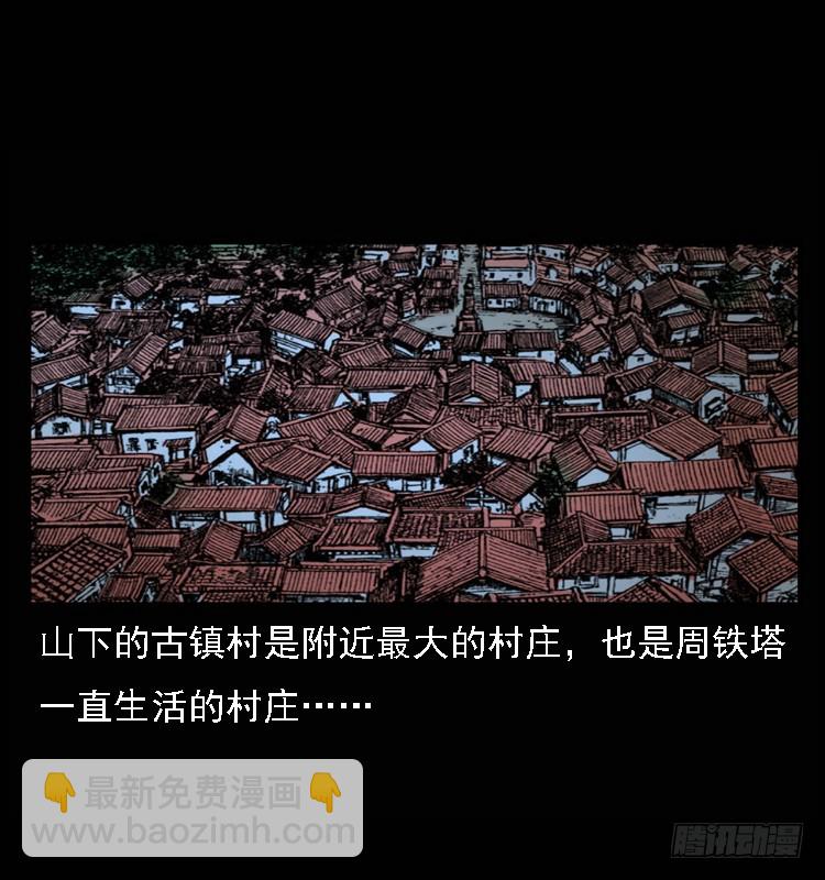 98痋术1(1/2)-第65话