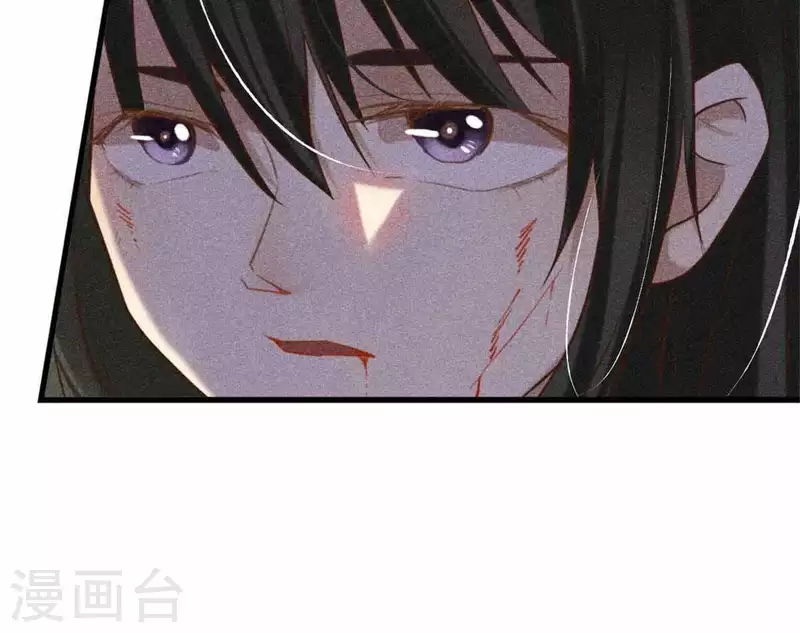 第8话 从此无痛(1/3)-第9话