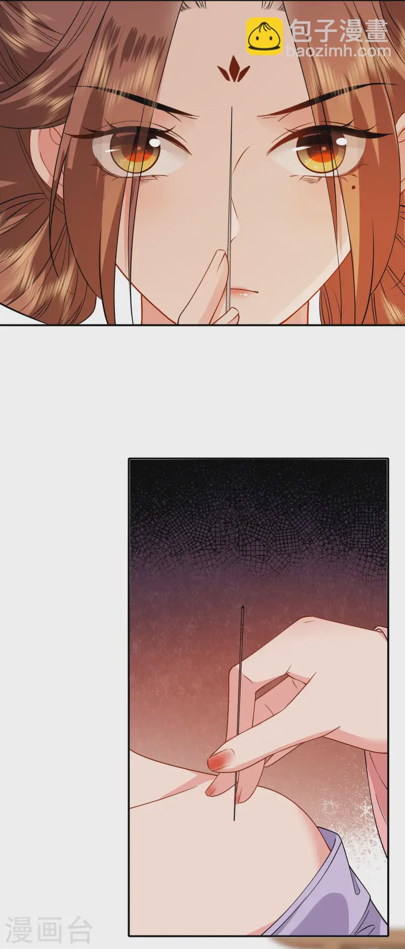 第83话 银针救命-第85话