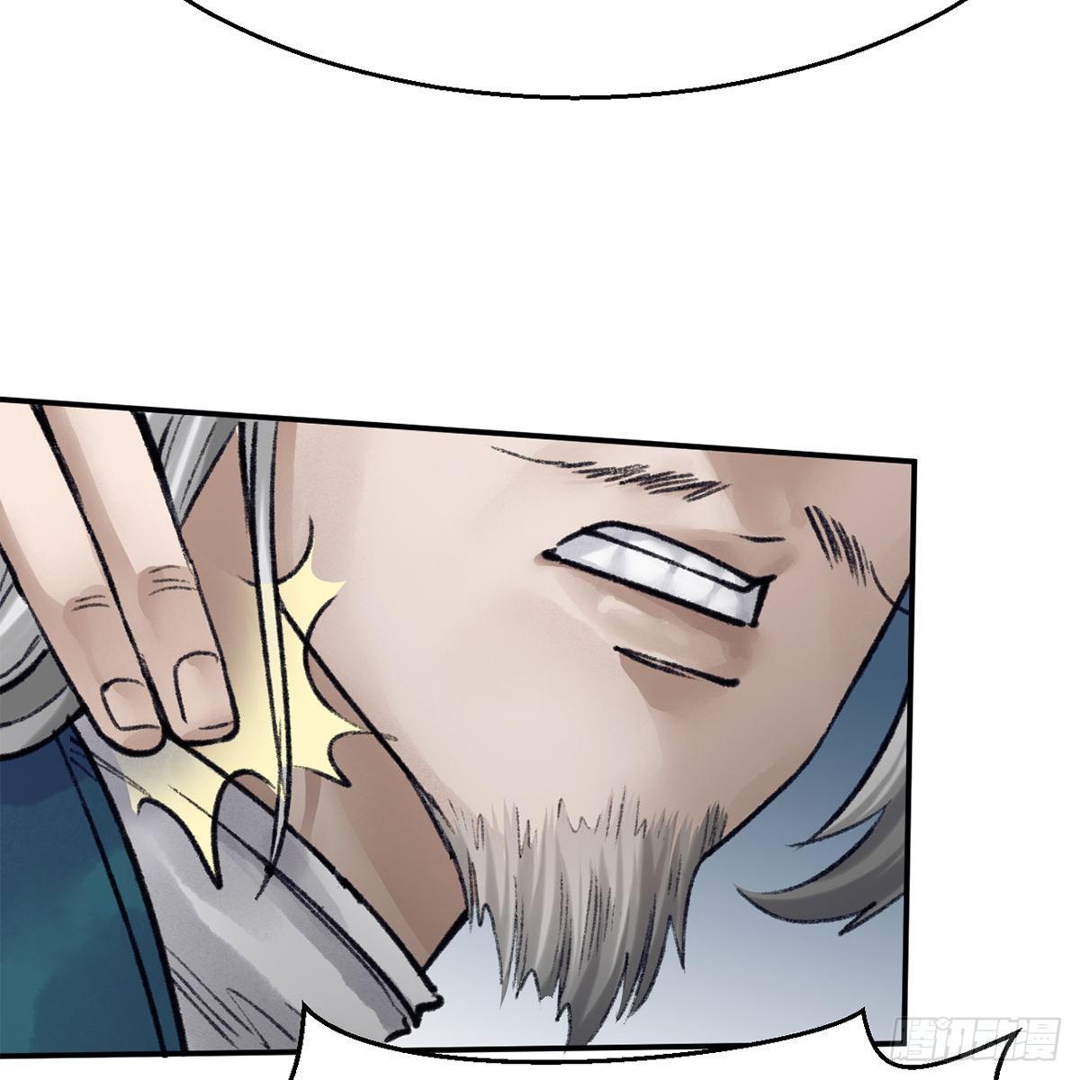 第五十二话 断腿之厄(1/2)-第53话