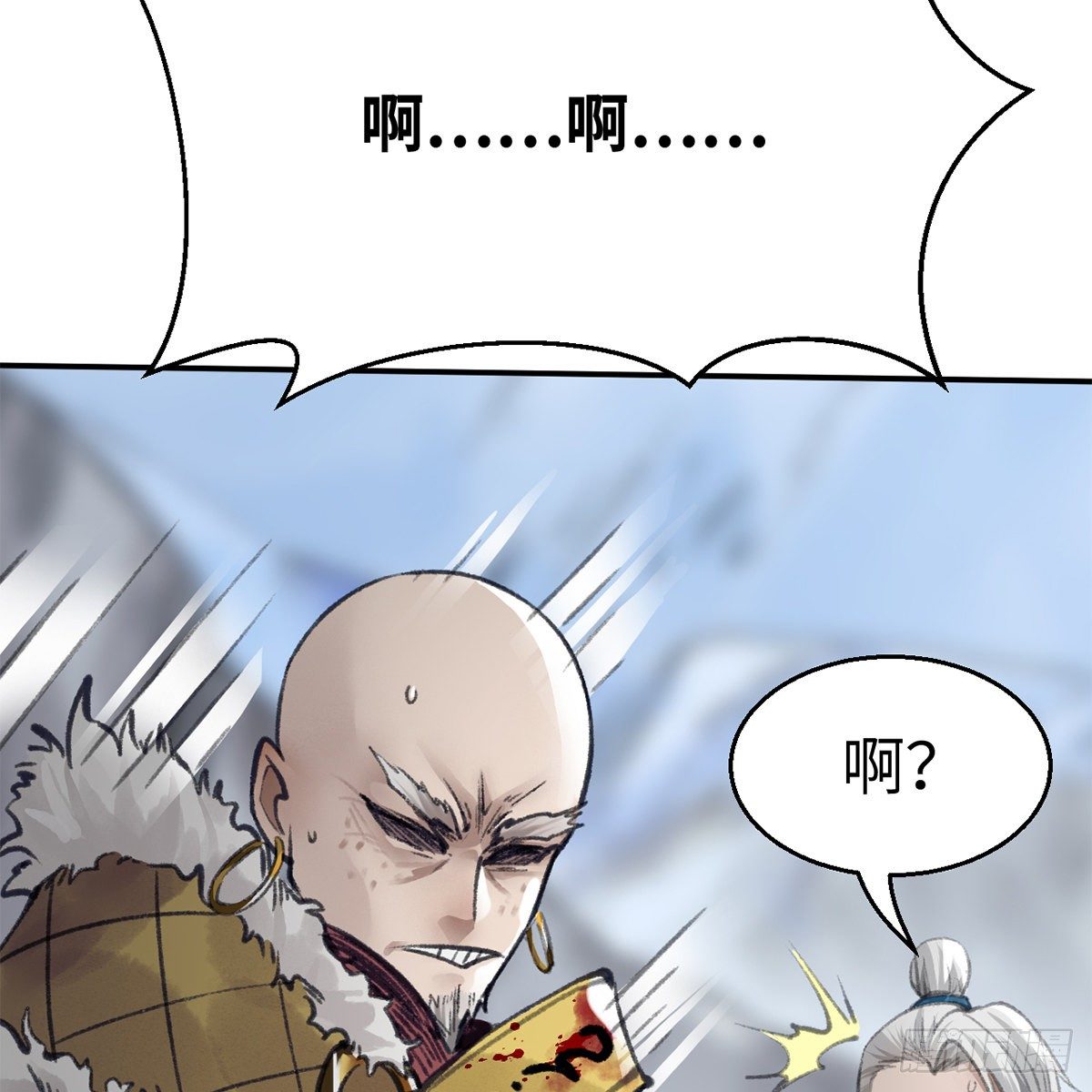 第五十二话 断腿之厄(1/2)-第53话