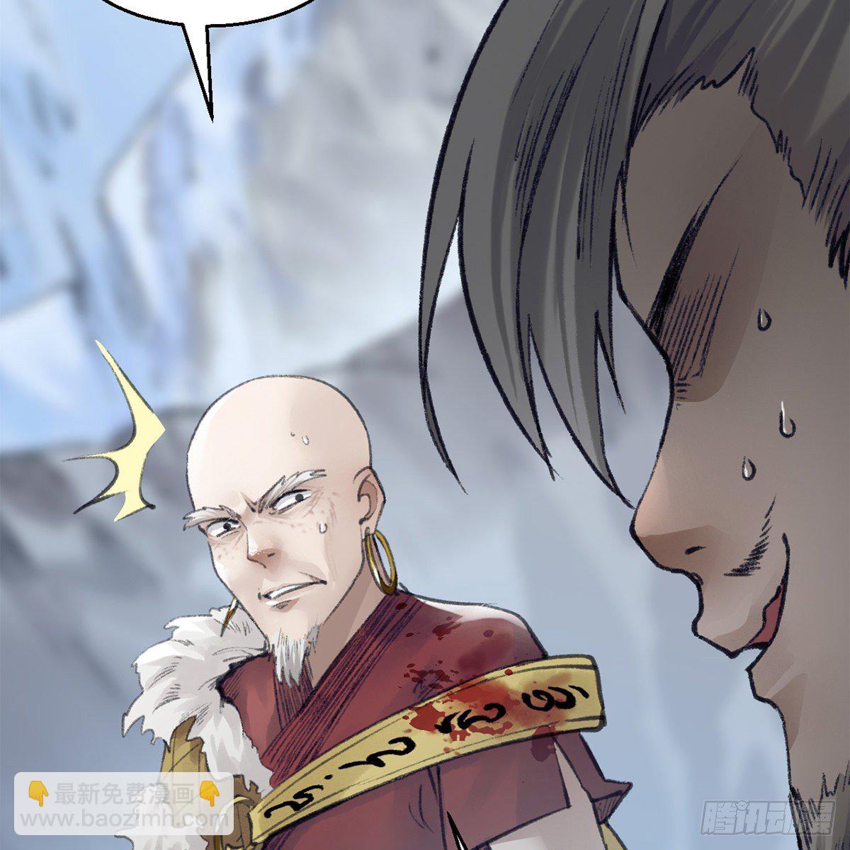 第五十二话 断腿之厄(1/2)-第53话