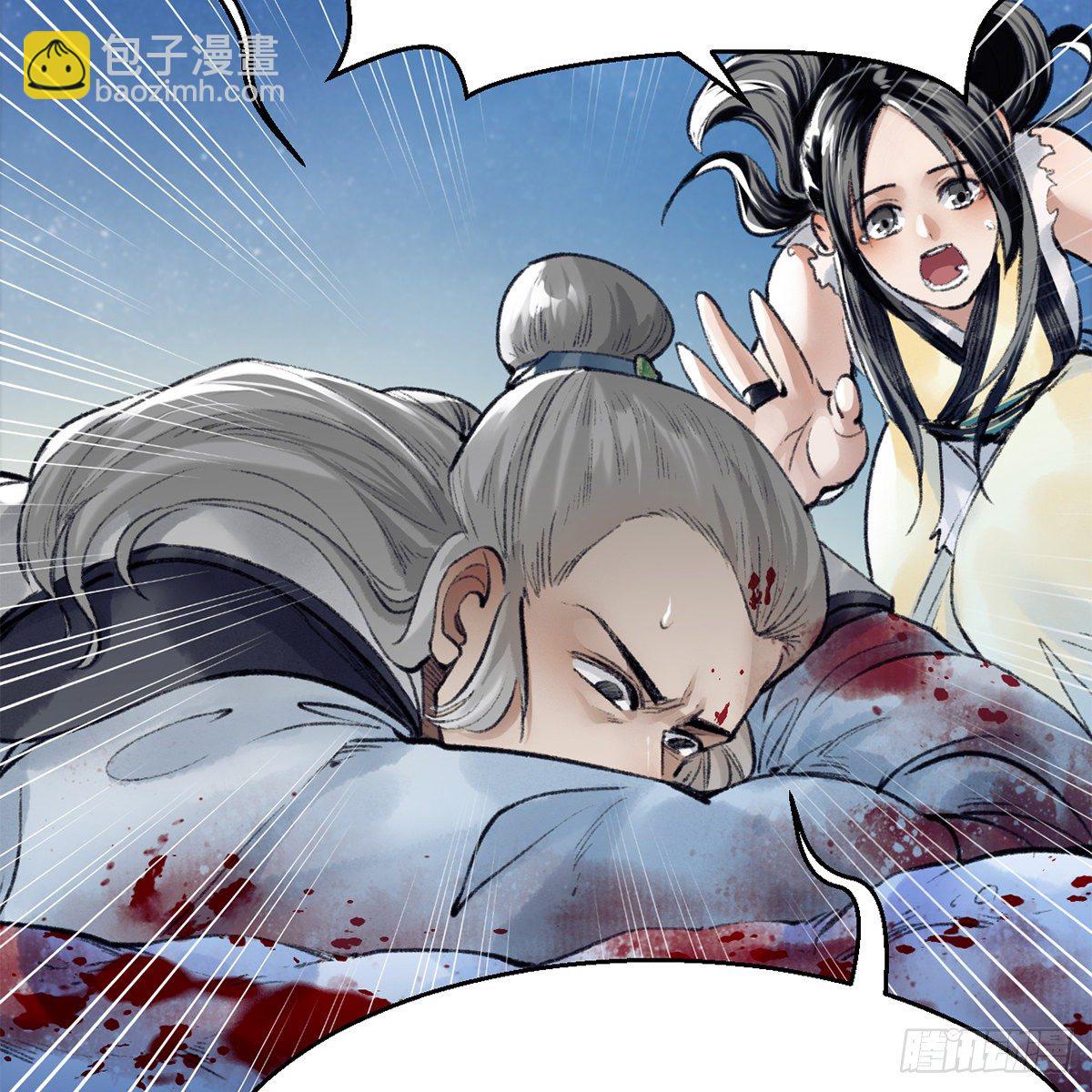 第五十二话 断腿之厄(1/2)-第53话