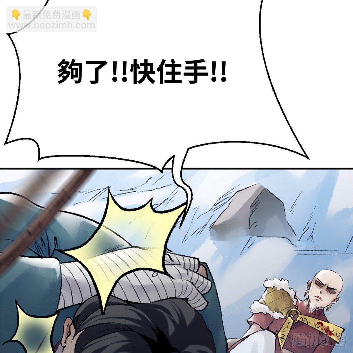 第五十二话 断腿之厄(1/2)-第53话