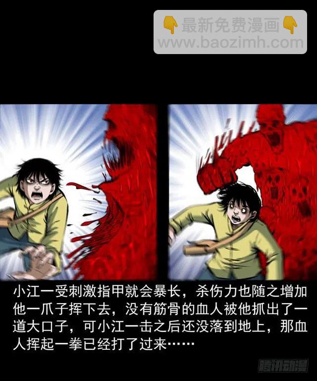 三十一话 血尸(1/2)-第31话