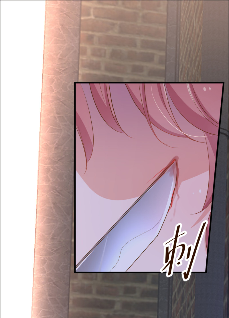 暖婚100分：總裁輕點寵 - 第87話 受到傷害 - 5