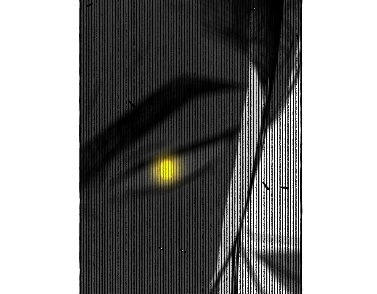 第62话 放他走吧(1/5)-第63话