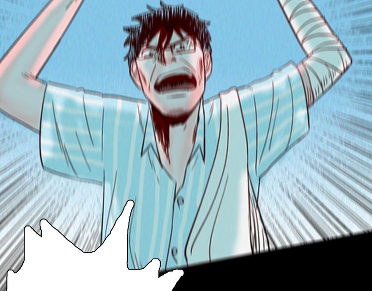 山林怪談 - 第63話 骨頭溶解症（上）(3/3) - 4