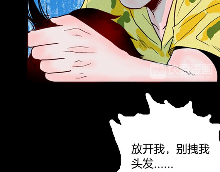 山林怪談 - 第63話 骨頭溶解症（上）(2/3) - 4