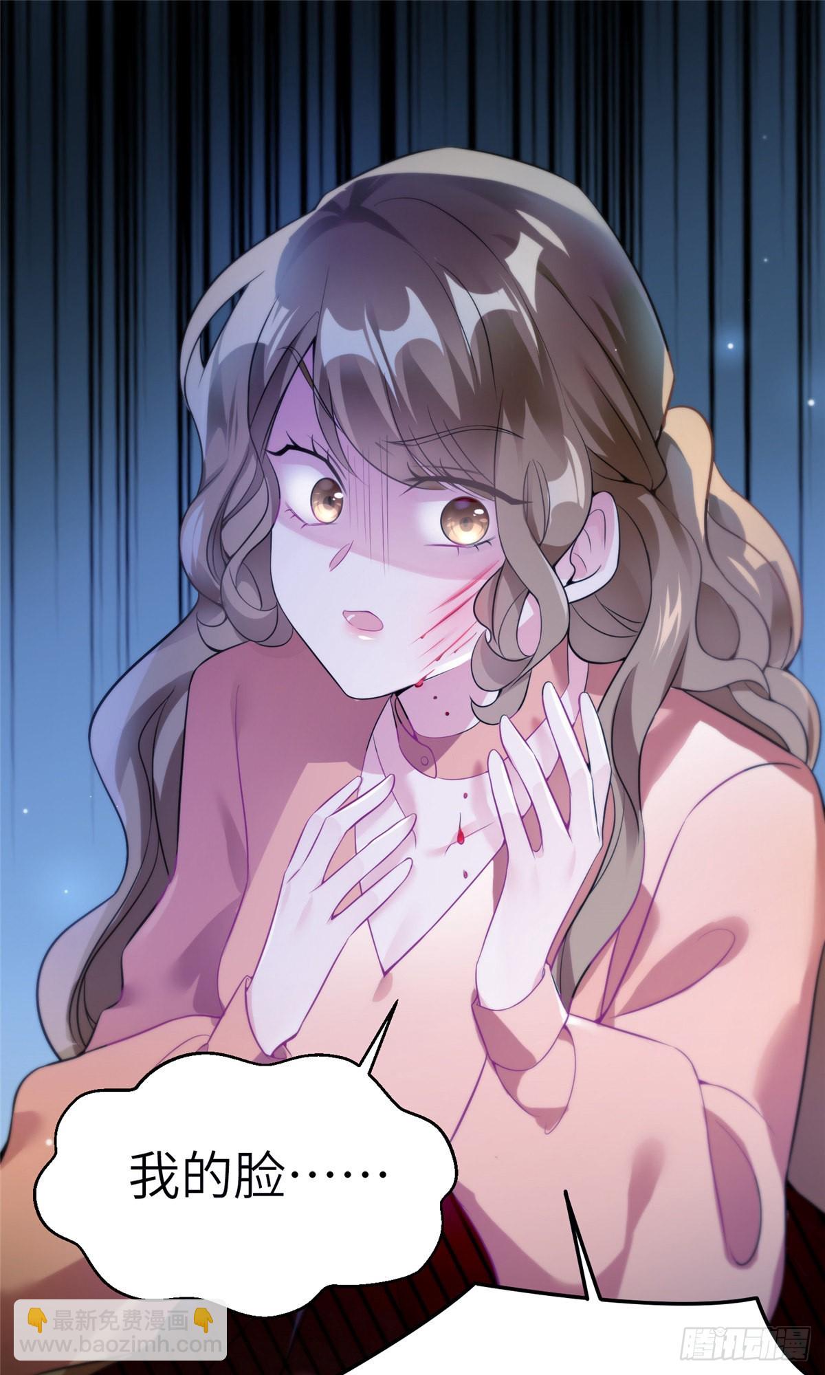 神秘枕邊人：boss，借個運 - 77 沈芷蘭毀容 - 7