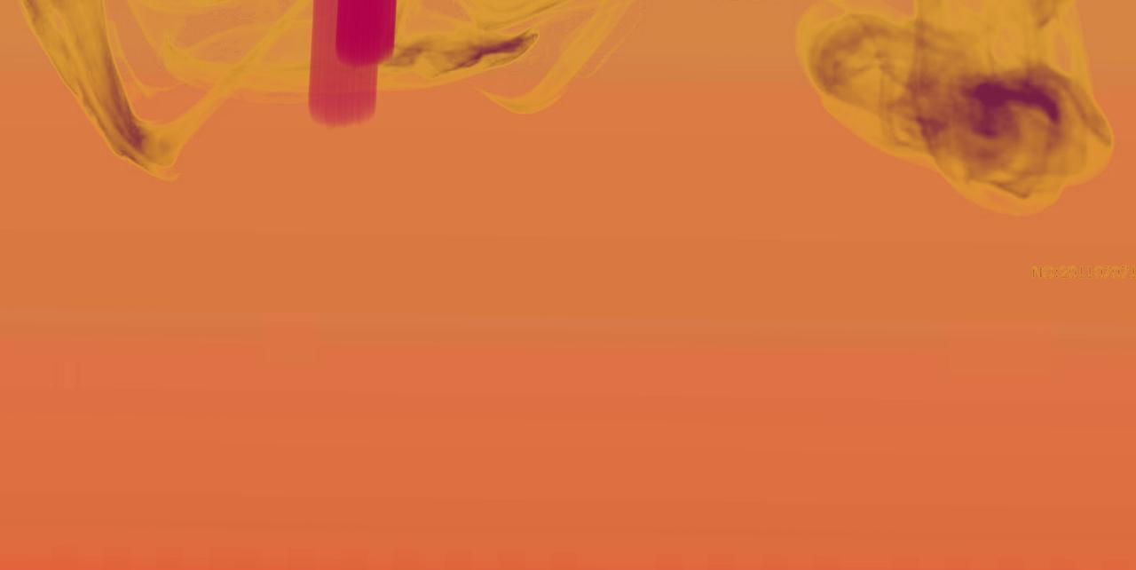 是不是该庆幸-第17话