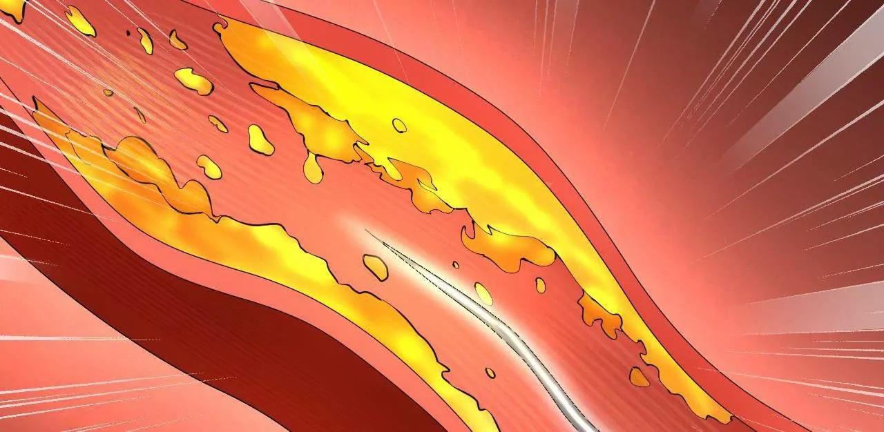 史上最強贅婿 - 341 	寧元憲腦梗！(3/3) - 1