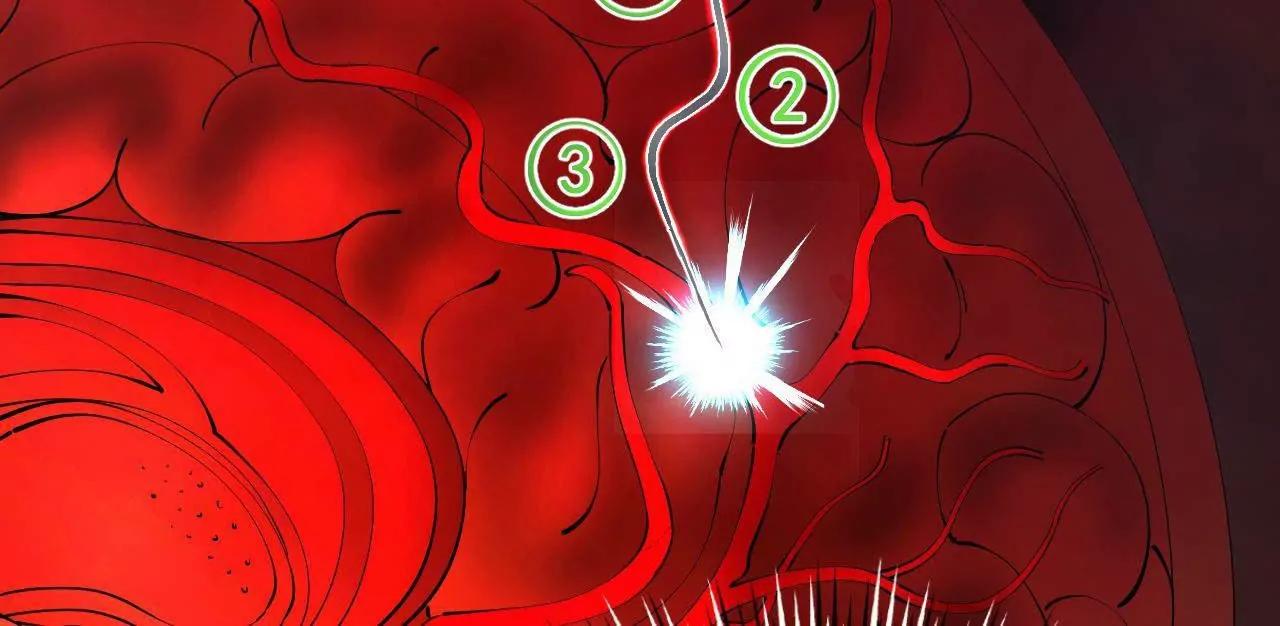 史上最強贅婿 - 341 	寧元憲腦梗！(2/3) - 2