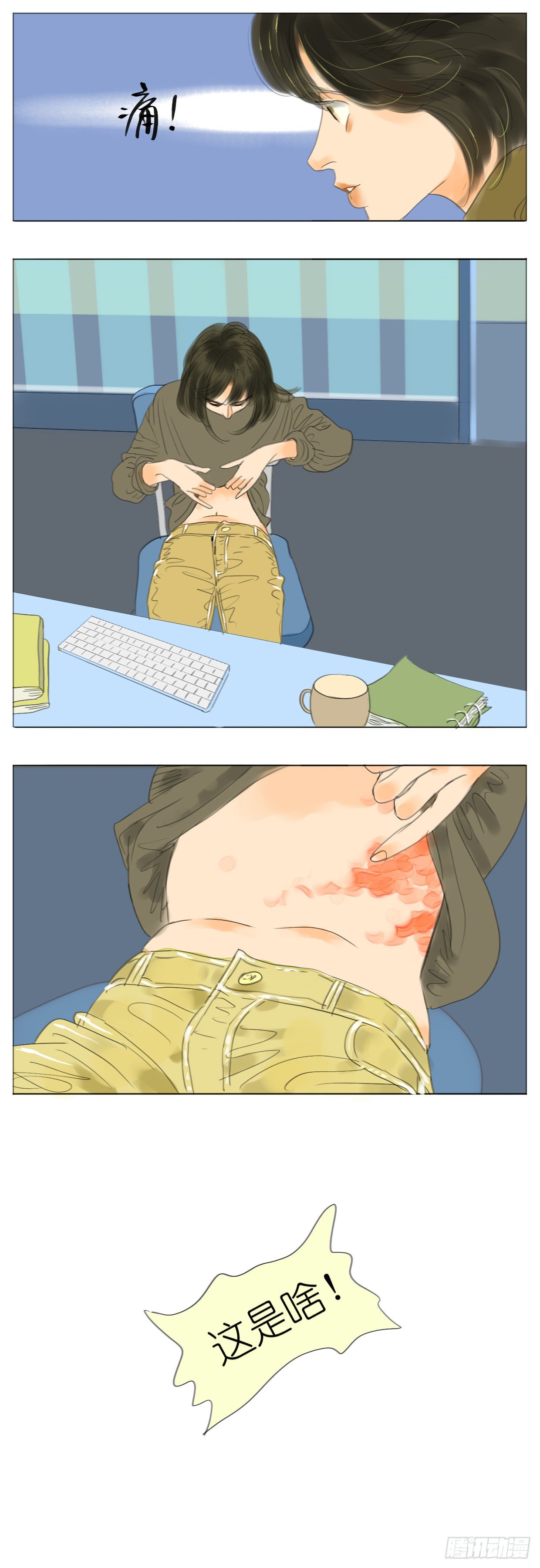 S1-32带状疱疹-第33话