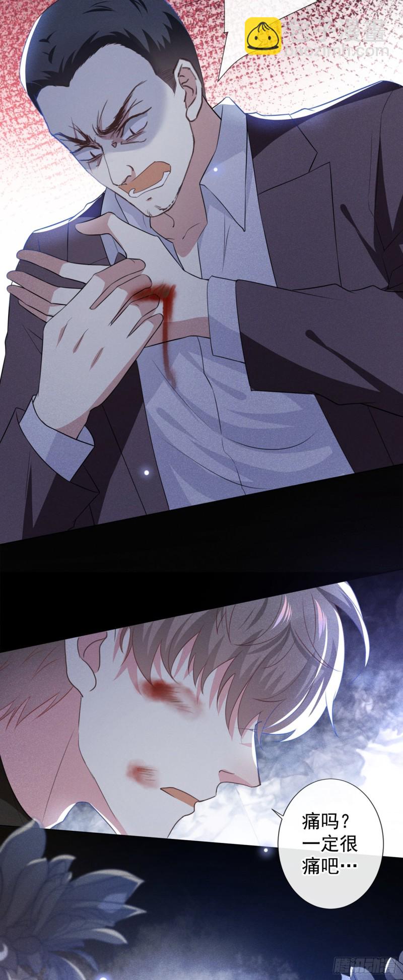 第73话 痛吗？一定很痛吧-第77话