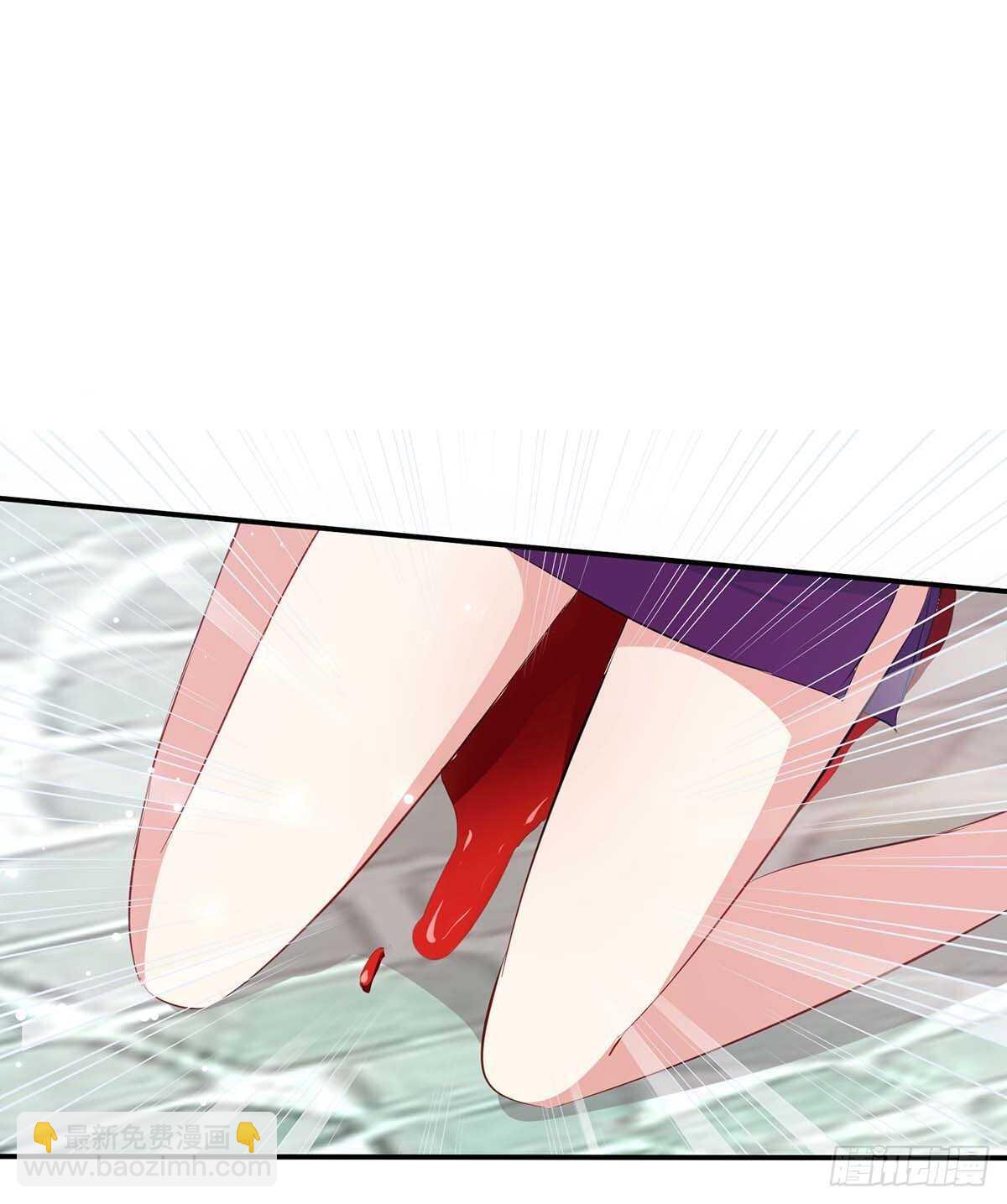 天才酷寶：總裁寵妻太強悍 - 第65話 摔倒 - 4