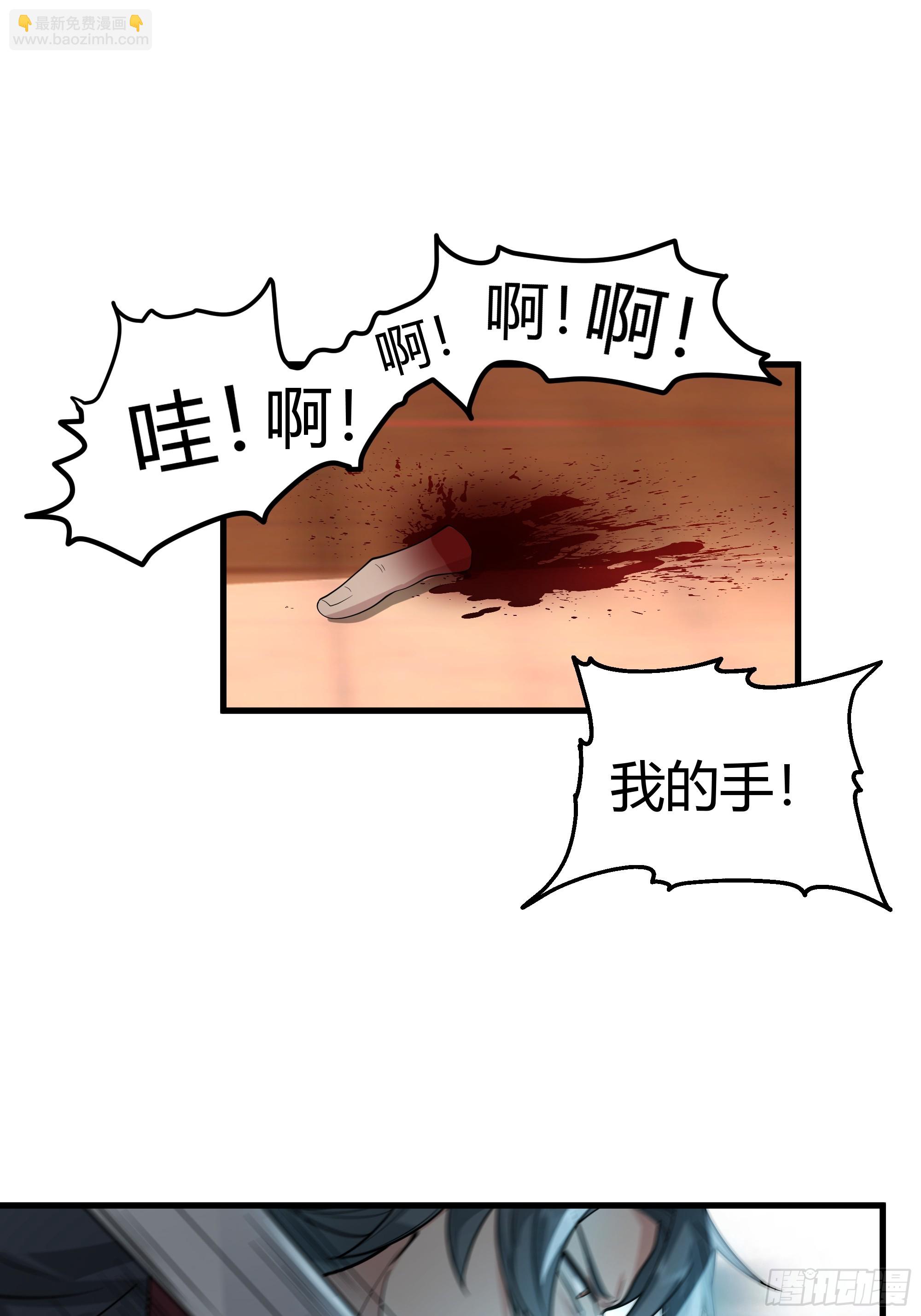 第14话-刀疤-第15话