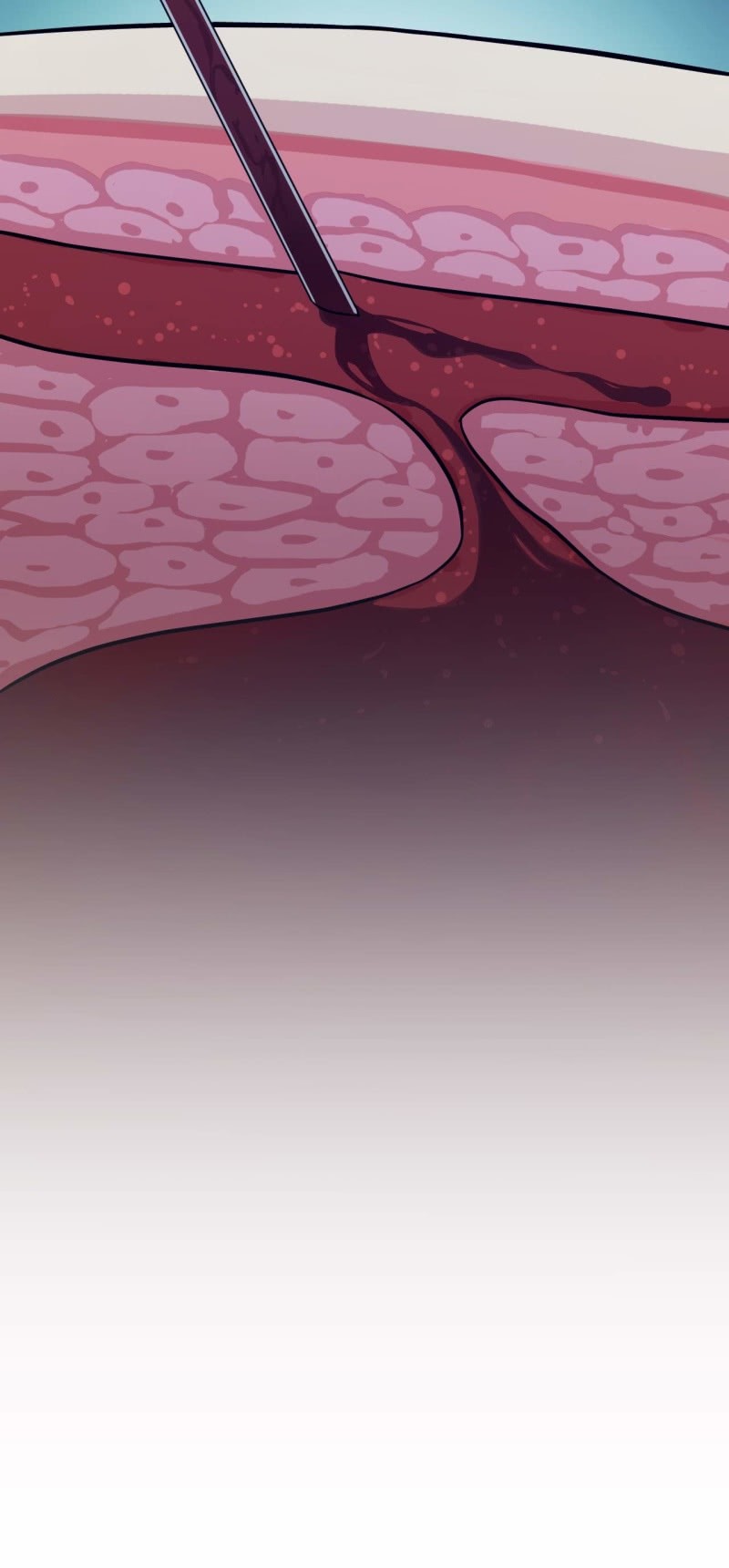 第84话 不让你冒险-第81话