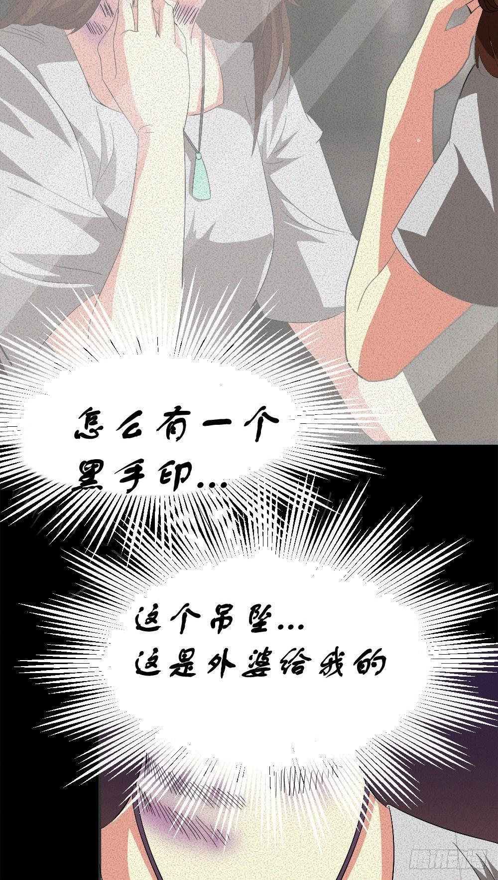 第五话 胎记能自愈-第5话