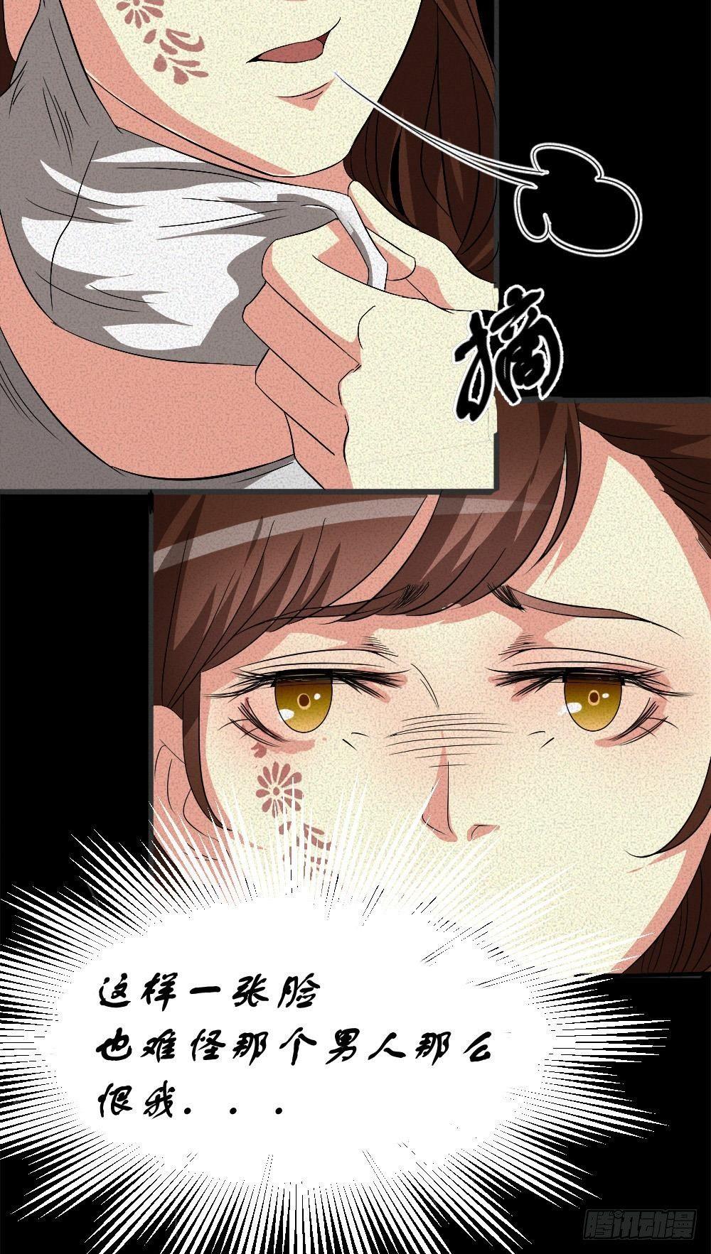 第五话 胎记能自愈-第5话