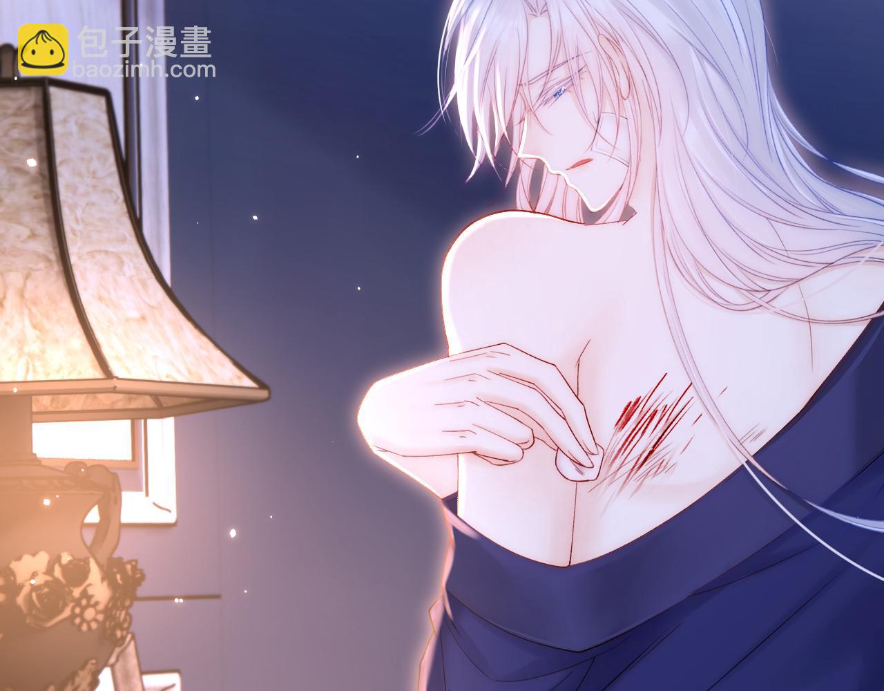 第142话 又咬我(1/2)-第147话