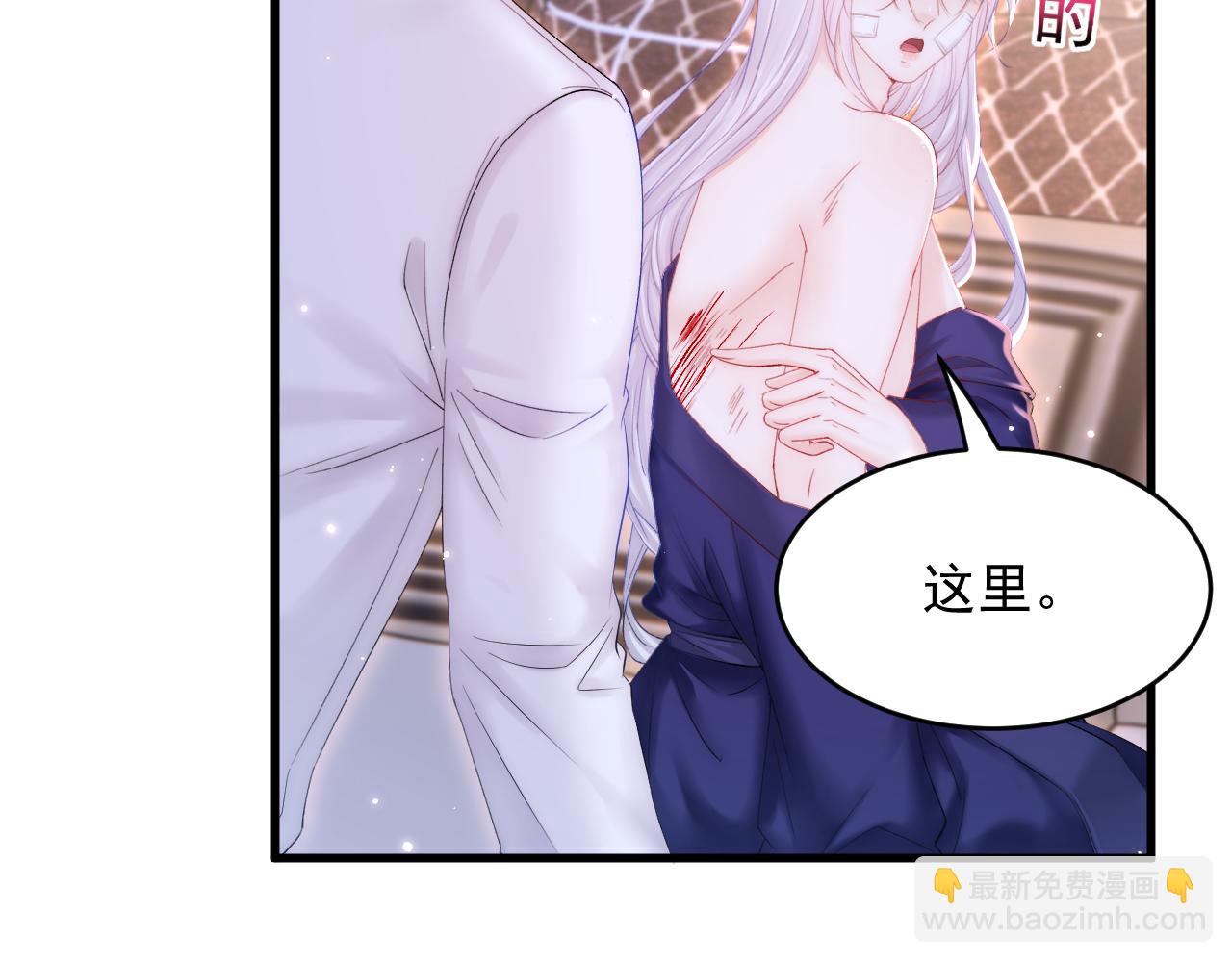 第142话 又咬我(1/2)-第147话