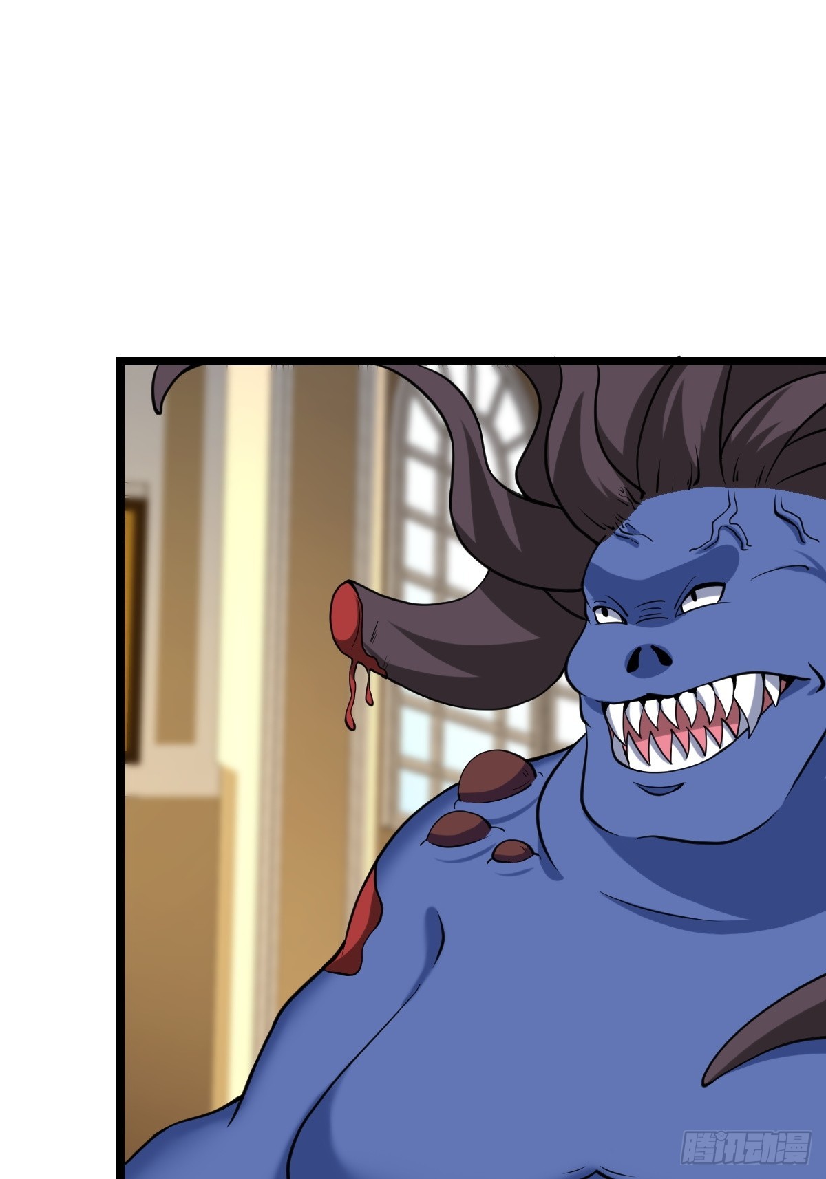 受伤(1/2)-第61话