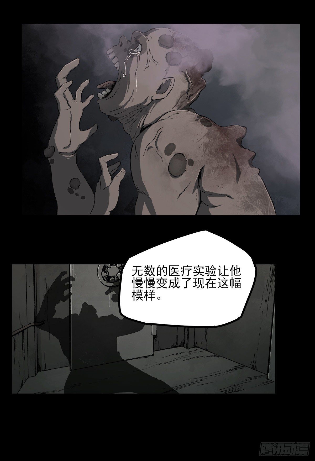 症 - 47.變質 - 2