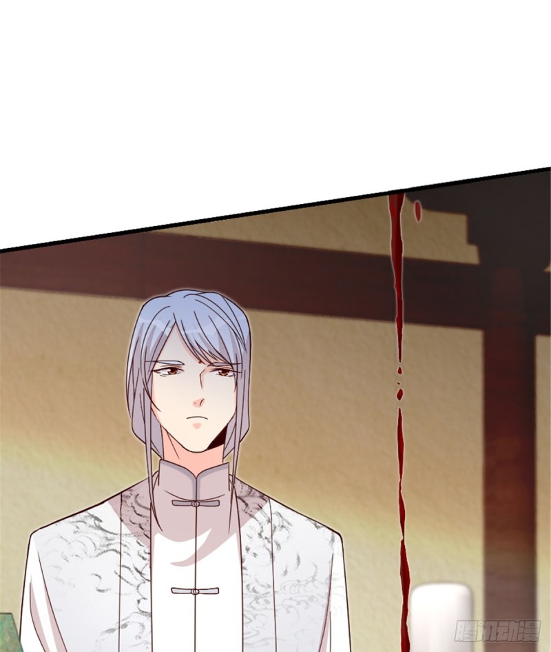 第178话(1/2)-第181话